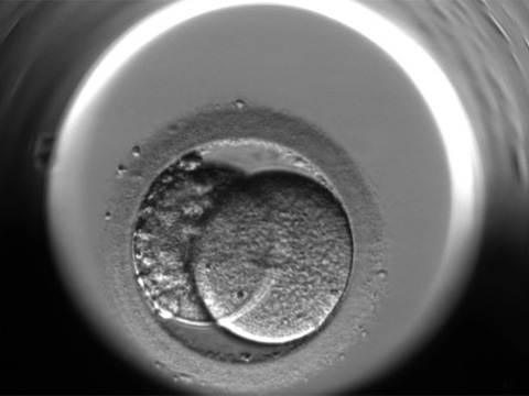 Embryoskope